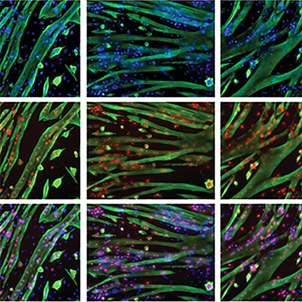 C2C12 myoblast cells immunohistochemically stained with DSHB antibodies MF 20 anti-MHC (green) and F5D anti-Myogenin (red). PMID: 36420144, Fig 1E.